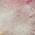 Blush color or pattern variation