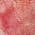 Pink color or pattern variation
