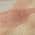 Coral color or pattern variation