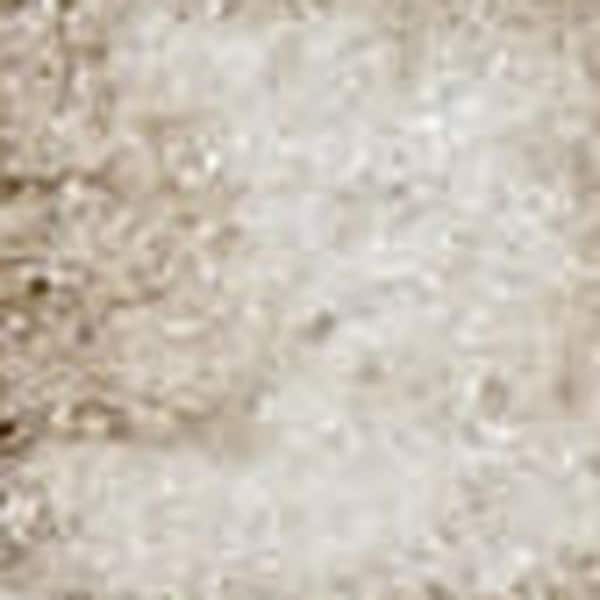 2 ft. x 8 ft. White Medallion Washable Area Rug