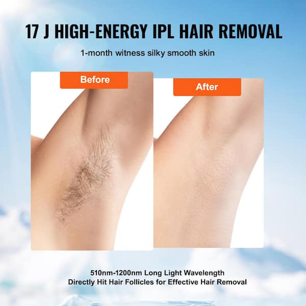 VEVOR Painless Hair Removal IPL Permanent Auto/Manual Modes and 5 Levels  for Women and Men At-Home Leg Armpit Bikini Line Body IPLJGTMQZNGYI9ZC9V1 -  The Home Depot